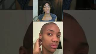 Rosemary oil for hair growth hairloss alopecia naturalhaircare 4chair hairregrowthoil [upl. by Ymma]