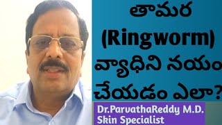 How to cure Ringworm disease [upl. by Janifer]