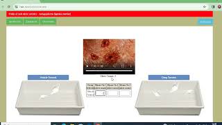 Experiment 22 Study of anti ulcer activity  using pylorus ligation method or SHAY method [upl. by Loats]