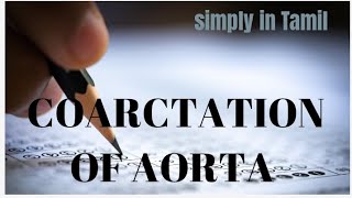 Coarctation of aorta  Detailed explanation in Tamil [upl. by Aubyn10]