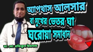 অ‌্যাপথাস আলসার এর ঘ‌রোয়া সমাধান  Aphthous ulcer in Bangla [upl. by Nauqet524]