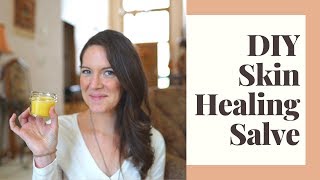 DIY Skin Healing Salve 3 Ingredients [upl. by Phiona]