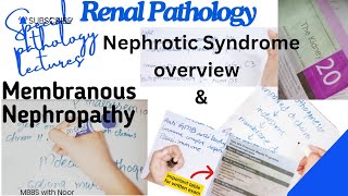 membranous nephropathy  nephrotic syndrome  renal pathology lectures  selflessmedicose [upl. by Oicangi644]