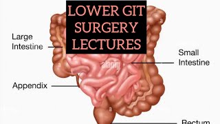 LOWER GIT SURGERY LECTURES part 2 Intestinal Tb surgerylectures [upl. by Ecnar]