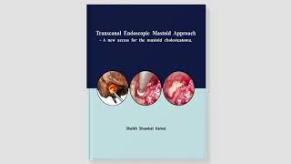 A peerreviewed book on “Transcanal Endoscopic Mastoid Approach” [upl. by Enilekaj981]