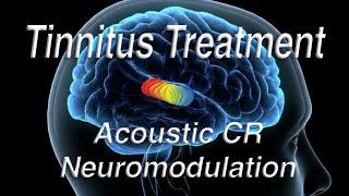 Tinnitus Treatment Using Acoustic Coordinated Reset Neuromodulation ACRN [upl. by Tait]