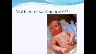 Mise à jour sur les allergies alimentaires  études de cas en pédiatrie [upl. by Adnawt]