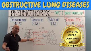 Obstructive Lung Diseases  COPD Chronic Bronchitis Asthma Bronchiectasis amp Emphysema🩺 [upl. by Kriste798]