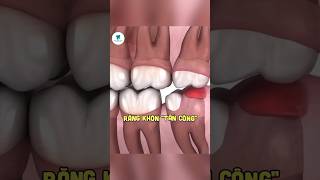 dentalcare dentalclinic nhatrang nhatrangdental nhakhoaopal dentist [upl. by Sinegra]