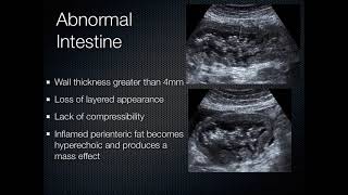 Gastrointestinal Genitourinary  GI GU Ultrasound [upl. by Jdavie]