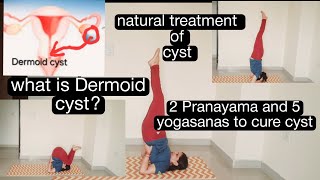 2 Pranayama and 5 yoga asanas to cure Dermoid cyst yogatocurecyst [upl. by Ainitsirhc]