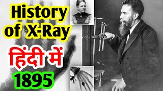 History of X  Ray In Hindi  Properties of X  Ray  TYPES OF X RAY  History of x ray discovery [upl. by Akierdna]