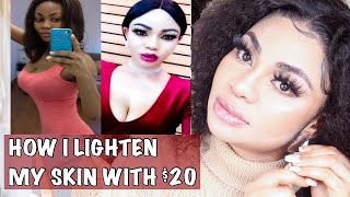 HOW I LIGHTEN MY SKIN With 20  SKIN WHITENING Naturally SKIN BLEACHING [upl. by Alimac]