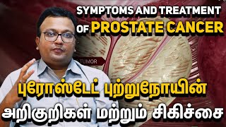 Prostate Cancer Symptoms amp Breakthrough Treatments  Onco Doctor Tamil Dr Dayananda Srinivasan [upl. by Bobby701]