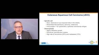 Cutaneous Squamous Cell Carcinoma  Updates in Immunotherapy presented by Dr Butler MD [upl. by Notlek437]