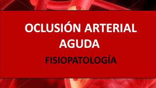 Oclusión arterial aguda  Fisiopatología [upl. by Jonme]