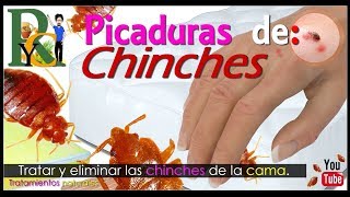 🕷️🐛 Picaduras de chinches  Piquetes de chinches  Como eliminar chinches de la cama picaduras 🛏️ [upl. by Niltiac878]