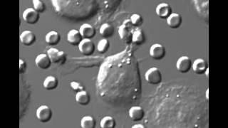 Macrophage engulfs foreign cells [upl. by La Verne]