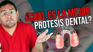 ¿NECESITAS PRÓTESIS DENTAL 👅 ¡Deberías ver este vídeo Ft Dentalk [upl. by Apfel]