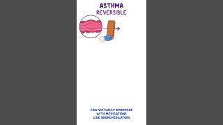 Clinical Cuts Asthma [upl. by Epilif]