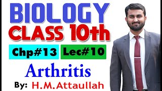 Arthritis  Chapter  13  Biology Class 10th  Lec 10 [upl. by Neeli154]