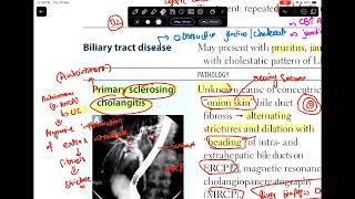 biliary tract diseases  GIT part8 [upl. by Andriette]