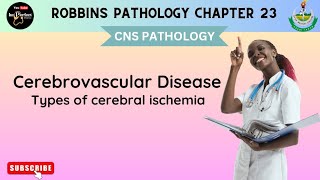 CEREBROVASCULAR DISEASES  Global Cerebral Ischemia  Focal Cerebral Ischemia  Robbins pathology [upl. by Cullen]