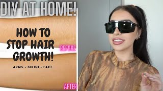 How I Remove ALL my unwanted hair at home permanently  My Experience [upl. by Edin728]