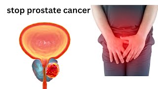 6 surprising things that can stop prostate cancer How to stop prostate cancer fast [upl. by Abbey]