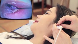 【ASMR】Experience the most professional visual ear cleaning Dig earwax relax ear massage [upl. by Alle344]