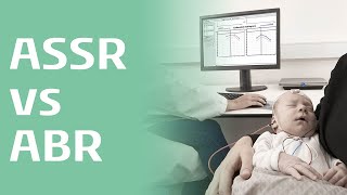 ASSR vs ABR Interview with Yvonne Sininger PhD [upl. by Isoj]