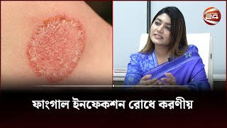 ফাংগাল ইনফেকশন রোধে করণীয়  Fungal infection  Channel 24 [upl. by Lorac612]