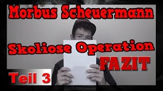 Skoliose Morbus Scheuermann Operation FAZIT DrissTalk63 [upl. by Ogir390]