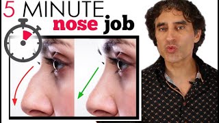 5 MINUTE NOSE JOB  Non Surgical Rhinoplasty [upl. by Ewens475]