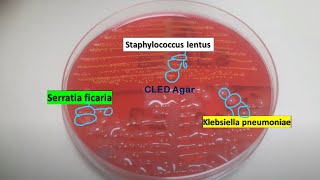 Staphylococcus lentus Klebsiella pneumoniae and Serratia ficaria on CLED Agar of Urine Culture [upl. by Gavrilla962]