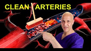 The Best Foods to Clean Arteries amp Reverse Plaque Prevent Heart Attack amp Stroke Dr Mandell [upl. by Samford]