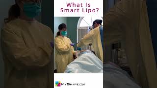 What is smart lipo [upl. by Matti]