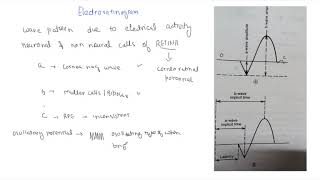 Electroretinogram [upl. by Trinia161]