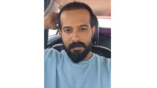 Going For Third Prp After Hairtransplantation LaDensitae Hair Transplantation Results🤍Subscribe Me [upl. by Aamsa]