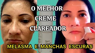 CREME CLAREADOR DE MELASMA E MANCHAS ESCURAS NA PELE  Tratamento NoturnoSilvania Sends [upl. by Ap]