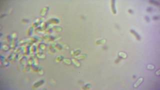 Bacteria Swimming At 5000X MagnificationMicroscope Hack [upl. by Assyram]