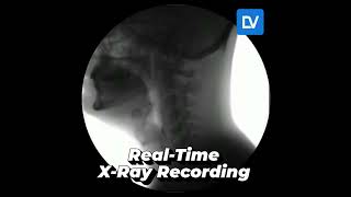 RealTime Xray – See How It WorksXrayTechnologies NDT Radiography xray xraytechnologist [upl. by Uund]