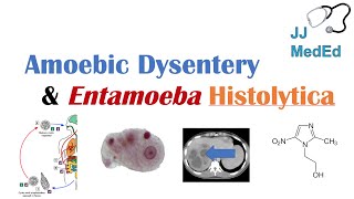 Amebiasis Amoebic Dysentery  Entamoeba histolytica Pathogenesis Signs amp Symptoms Treatment [upl. by Naimad]