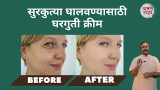 सुरकुत्या घालवण्यासाठी घरगुती क्रीम।How To Get Rid Of Face Wrinkles  Wrinkles Removal  Surkutya [upl. by Niko124]