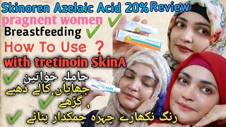 Skinoren Cream20Azelaic Acid Review How To Use Azelaic Acid With TretinoinSkinA Cream Retinoid [upl. by Morris]