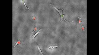 Human HT1080 Fibrosarcoma Cells on Etaluma LS600 [upl. by Anaujik125]