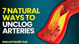 Unclog Arteries 7 natural ways to clean your arteries [upl. by Einittirb]