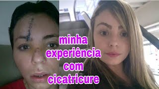 CICATRICURE FUNCIONA Minha experiência [upl. by Ellicott]