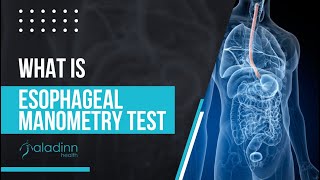 What is Esophageal Manometry Test  Dr Prabhat Narayan Sharma [upl. by Elik25]