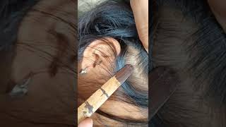 LICEPOPPING lice hair satisfying liceremoval haircare hairstyle hairextensions longhair [upl. by Ylellan]